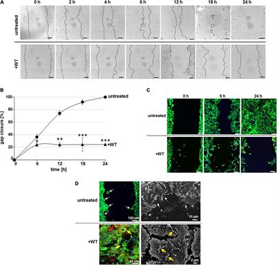 Streptococcus pneumoniae Affects Endothelial Cell Migration in Microfluidic Circulation